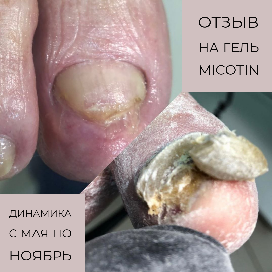 Заголовок